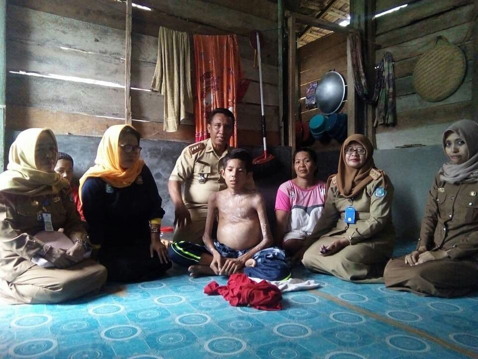Dinsos Target Disabilitas Tak Produktif Jadi Mandiri